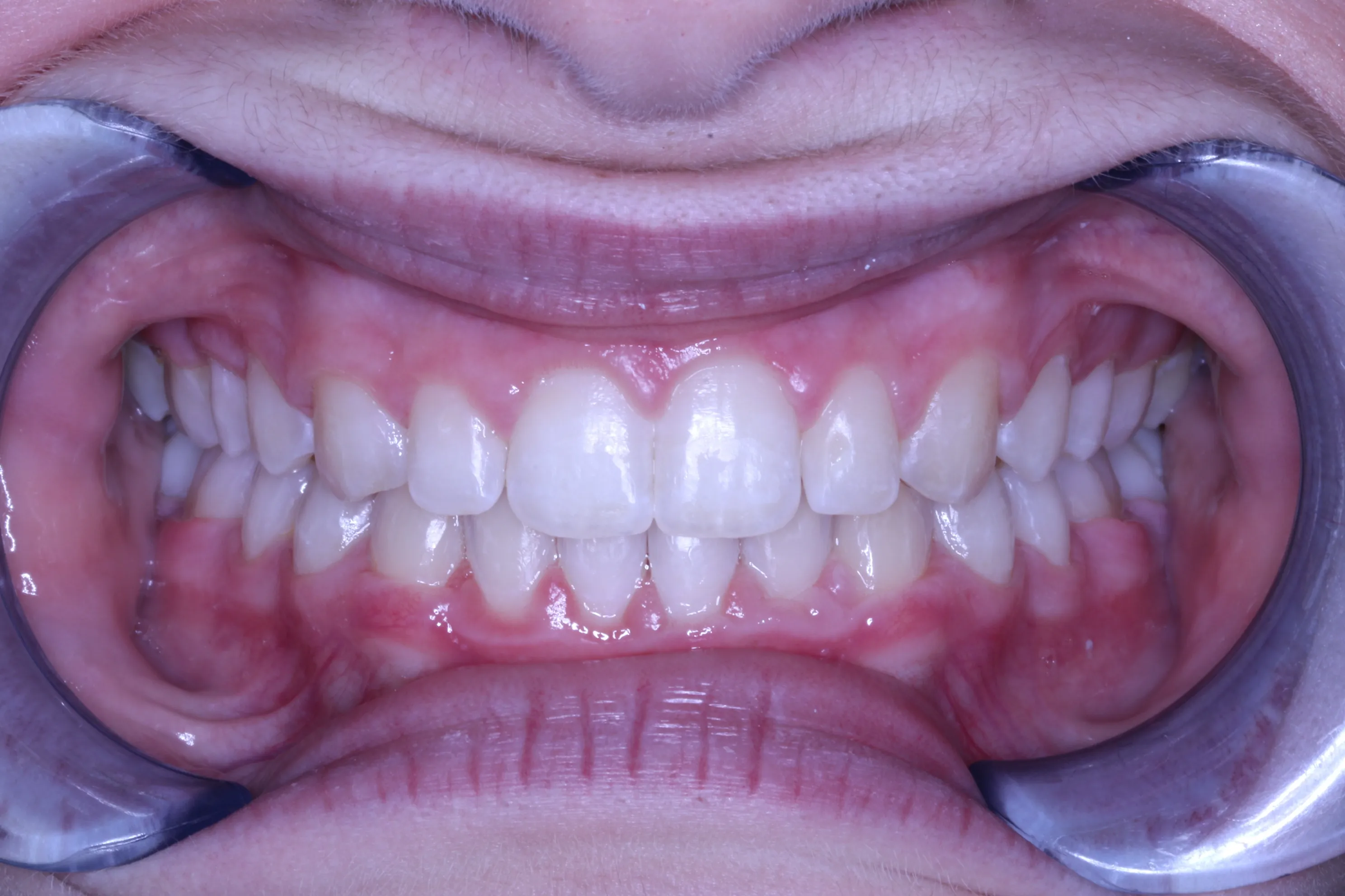 smile-gallery gallery